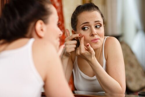 Acne: Types and Treatments