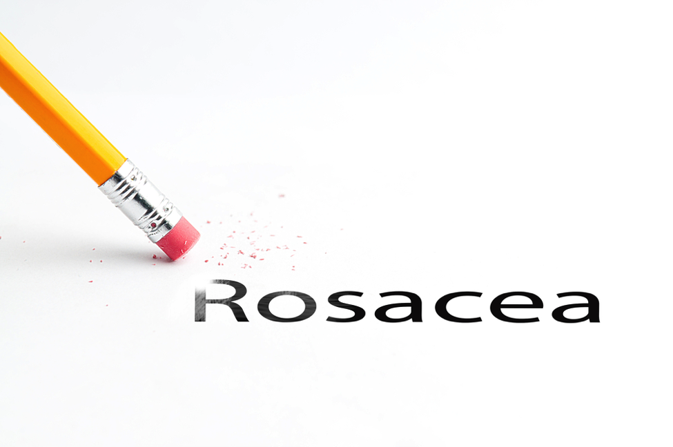 Controlling Rosacea